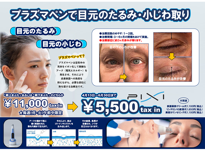 プラズマペンで目元のたるみ・小じわ取り☆限定価格☆