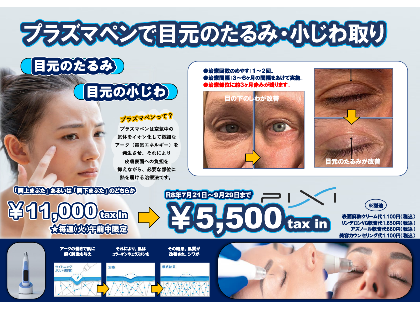 プラズマペンで目元のたるみ・小じわ取り☆期間限定特別価格☆