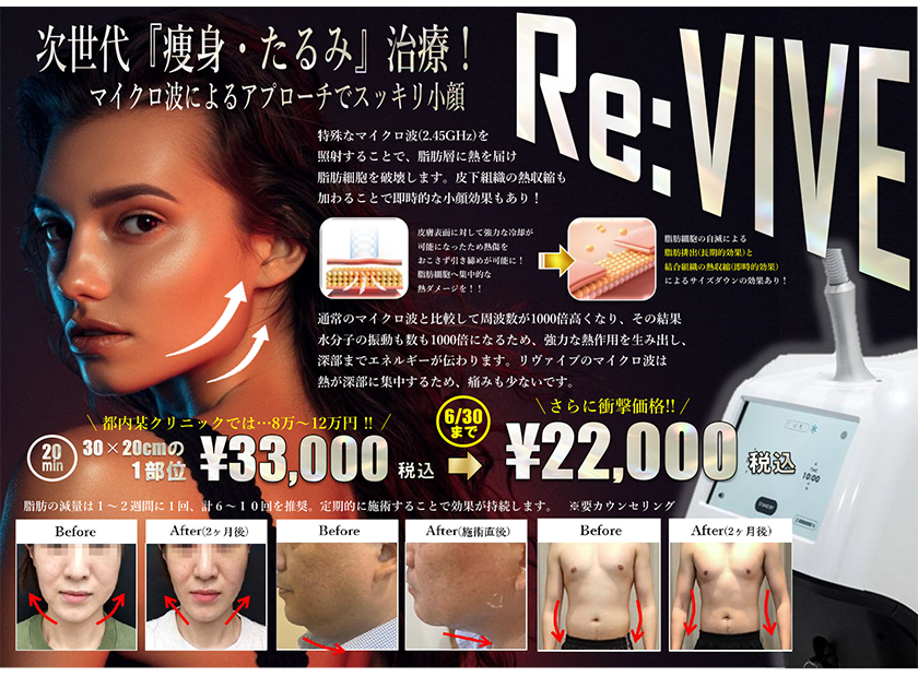 次世代『痩身・たるみ』治療！マイクロ波によるアプローチでスッキリ小顔