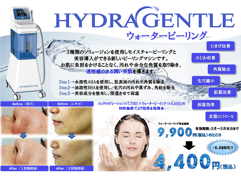 透明感のある潤い美肌へ☆ウォーターピーリングが驚きの期間限定特別価格！！